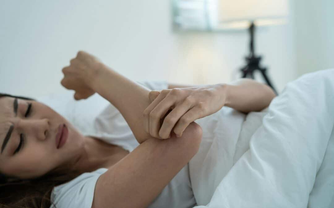 How to Handle a Bed Bug Infestation Over the Holidays